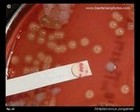 GAS positive PYR test